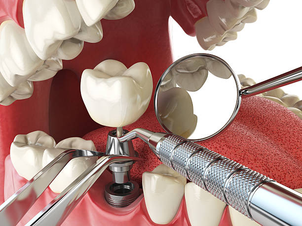 Best Pediatric Emergency Dentist in Wakarusa, IN
